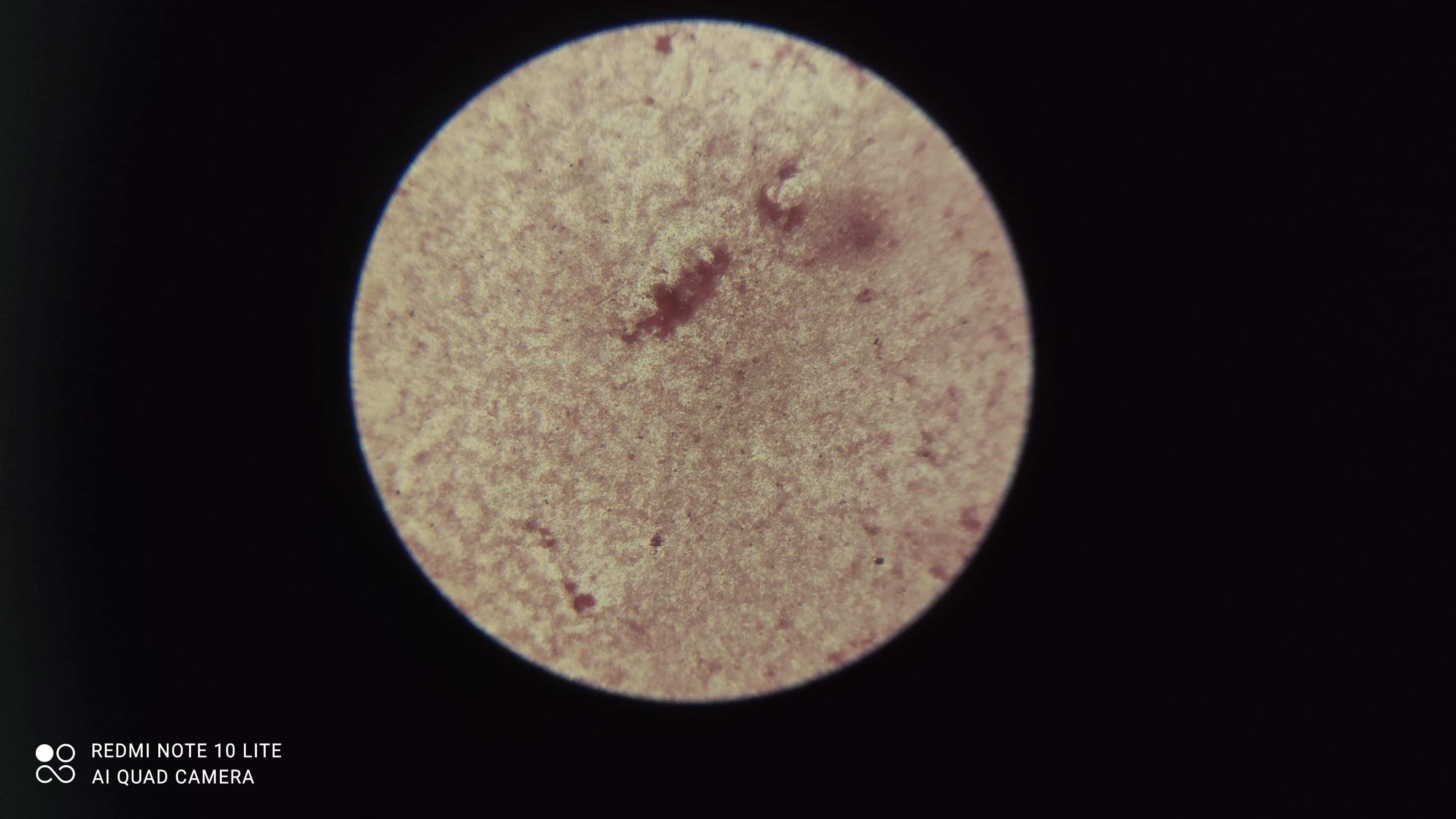Bacteria grown in Water sample from   Sports Graund